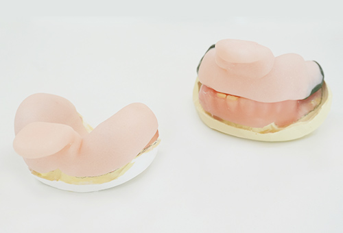 院長がこだわって製作する入れ歯